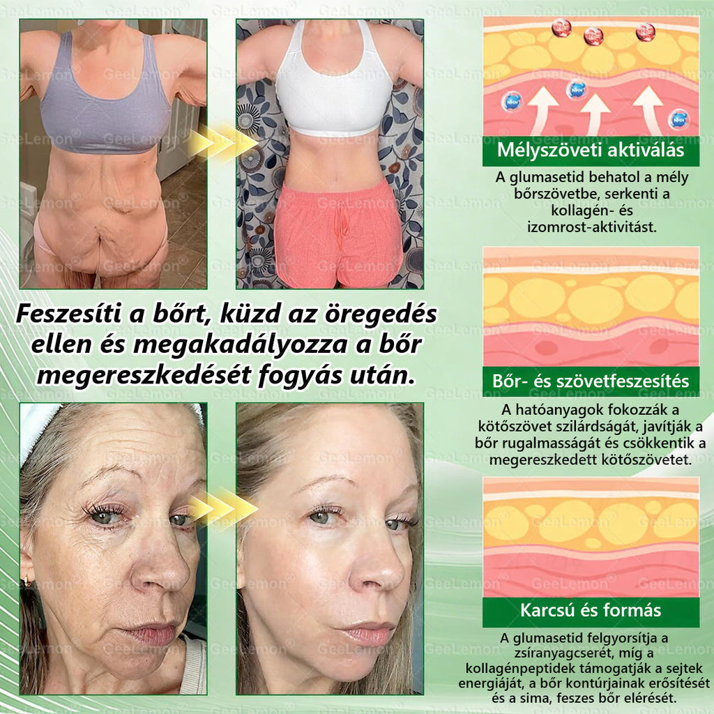 🌱🌱Moringa · Berberine × NAD+ 10-in-1 Advanced Nano GeeLemon® Glumasetide 8az 1-ben Karcsú és EgészségesNano Mikrotűs Tapasz (Napi 1alkalom – látható változásakár 7 nap alatt) ✅ Elhízásra,bőrfeszesítésre,cukorbetegségre, alvásiapnoéra, ízületekre stb HU