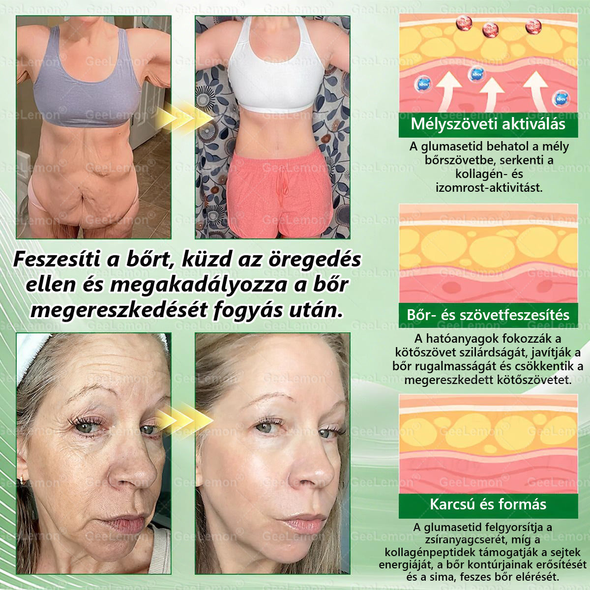🌱🌱Moringa · Berberine × NAD+ 10-in-1 Advanced Nano GeeLemon® Glumasetide 8az 1-ben Karcsú és EgészségesNano Mikrotűs Tapasz (Napi 1alkalom – látható változásakár 7 nap alatt) ✅ Elhízásra,bőrfeszesítésre,cukorbetegségre, alvásiapnoéra, ízületekre stb HU
