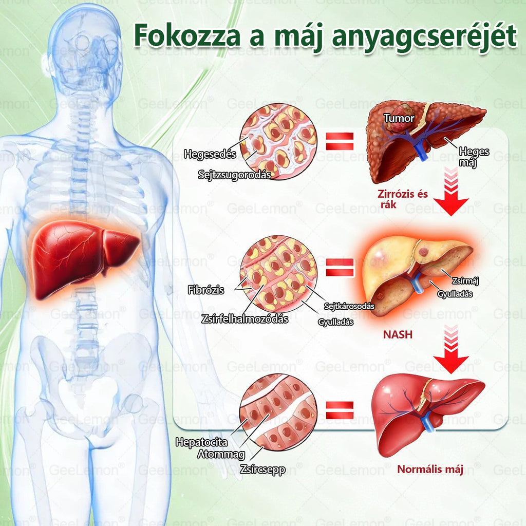 🌱🌱Moringa · Berberine × NAD+ 10-in-1 Advanced Nano GeeLemon® Glumasetide 8az 1-ben Karcsú és EgészségesNano Mikrotűs Tapasz (Napi 1alkalom – látható változásakár 7 nap alatt) ✅ Elhízásra,bőrfeszesítésre,cukorbetegségre, alvásiapnoéra, ízületekre stb HU