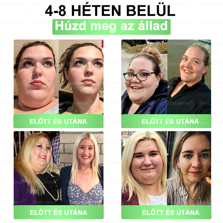 🌱🌱Moringa · Berberine × NAD+ 10-in-1 Advanced Nano GeeLemon® Glumasetide 8az 1-ben Karcsú és EgészségesNano Mikrotűs Tapasz (Napi 1alkalom – látható változásakár 7 nap alatt) ✅ Elhízásra,bőrfeszesítésre,cukorbetegségre, alvásiapnoéra, ízületekre stb HU