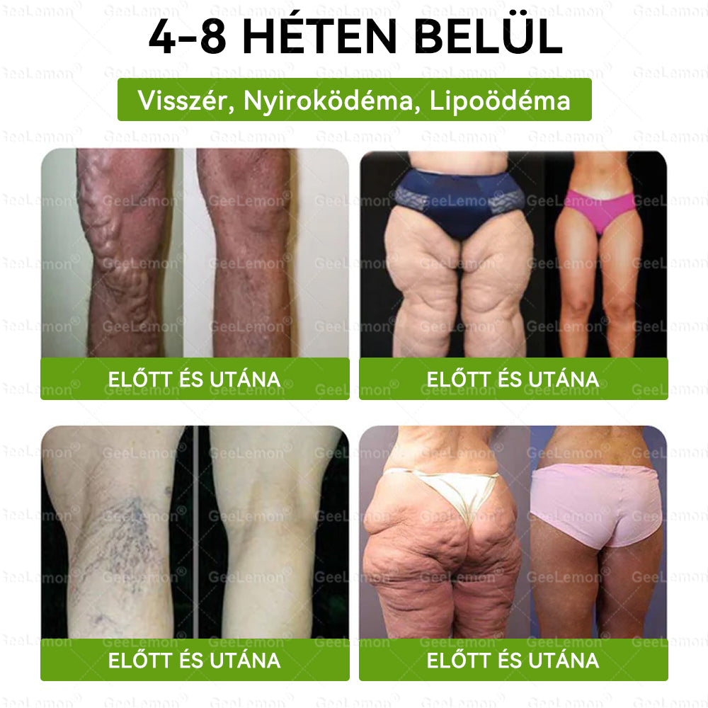 🌱🌱Moringa · Berberine × NAD+ 10-in-1 Advanced Nano GeeLemon® Glumasetide 8az 1-ben Karcsú és EgészségesNano Mikrotűs Tapasz (Napi 1alkalom – látható változásakár 7 nap alatt) ✅ Elhízásra,bőrfeszesítésre,cukorbetegségre, alvásiapnoéra, ízületekre stb HU