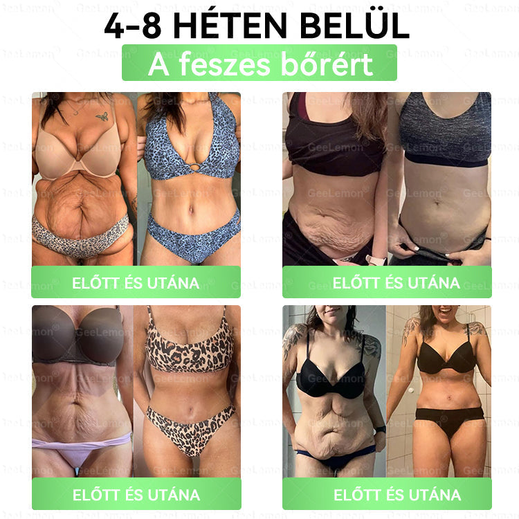 🌱🌱Moringa · Berberine × NAD+ 10-in-1 Advanced Nano GeeLemon® Glumasetide 8az 1-ben Karcsú és EgészségesNano Mikrotűs Tapasz (Napi 1alkalom – látható változásakár 7 nap alatt) ✅ Elhízásra,bőrfeszesítésre,cukorbetegségre, alvásiapnoéra, ízületekre stb HU
